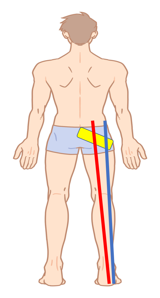 筋膜　流れ　説明　図